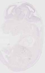 EMAGE:13507
