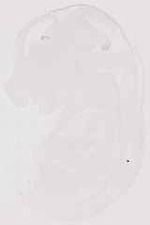 EMAGE:13511