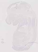 EMAGE:13511