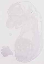 EMAGE:13511
