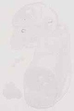 EMAGE:13511