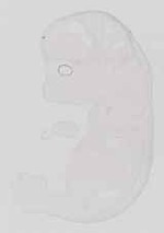 EMAGE:13581