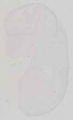 EMAGE:13581