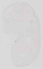 EMAGE:13581