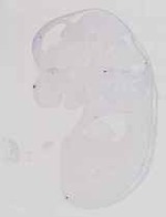 EMAGE:13581
