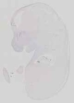 EMAGE:13581
