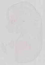 EMAGE:13581