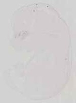 EMAGE:13581