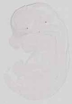 EMAGE:13581