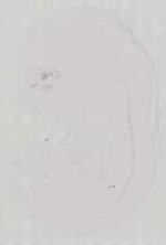 EMAGE:13581