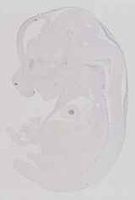 EMAGE:13581