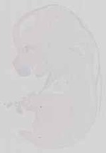EMAGE:13581