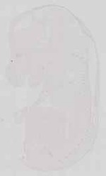 EMAGE:13581