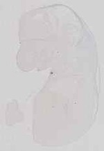 EMAGE:13581