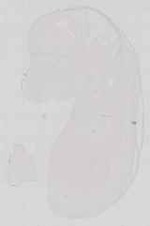 EMAGE:13581