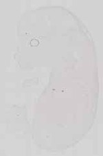 EMAGE:13581