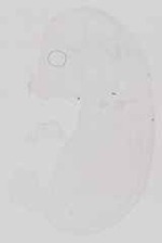 EMAGE:13581