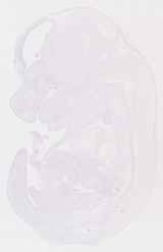 EMAGE:13589