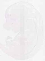 EMAGE:13599