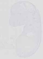 EMAGE:13650