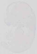 EMAGE:13650