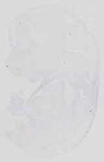 EMAGE:13650