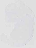 EMAGE:13650