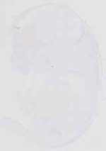 EMAGE:13651