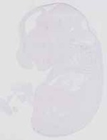 EMAGE:13654