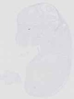 EMAGE:13654