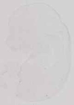 EMAGE:13655