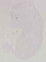 EMAGE:13655