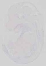 EMAGE:13688