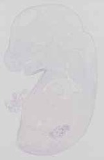 EMAGE:13719