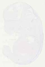 EMAGE:13746