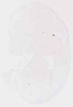 EMAGE:13746