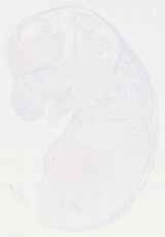 EMAGE:13746