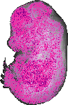 mouse atlas EMAGE spatial in situ gene expression database None