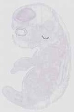 EMAGE:13790