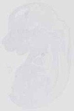 EMAGE:13804