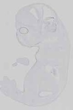 EMAGE:13872