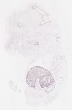 EMAGE:13944