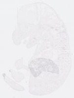 EMAGE:13948