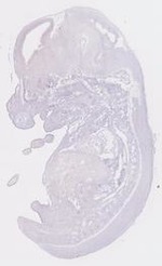 EMAGE:13953