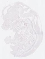 EMAGE:13957