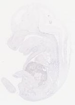 EMAGE:13980