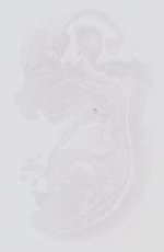 EMAGE:13984
