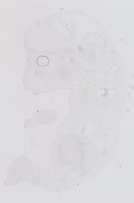 EMAGE:13996