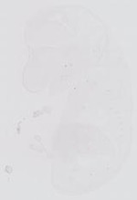 EMAGE:14004
