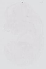 EMAGE:14004
